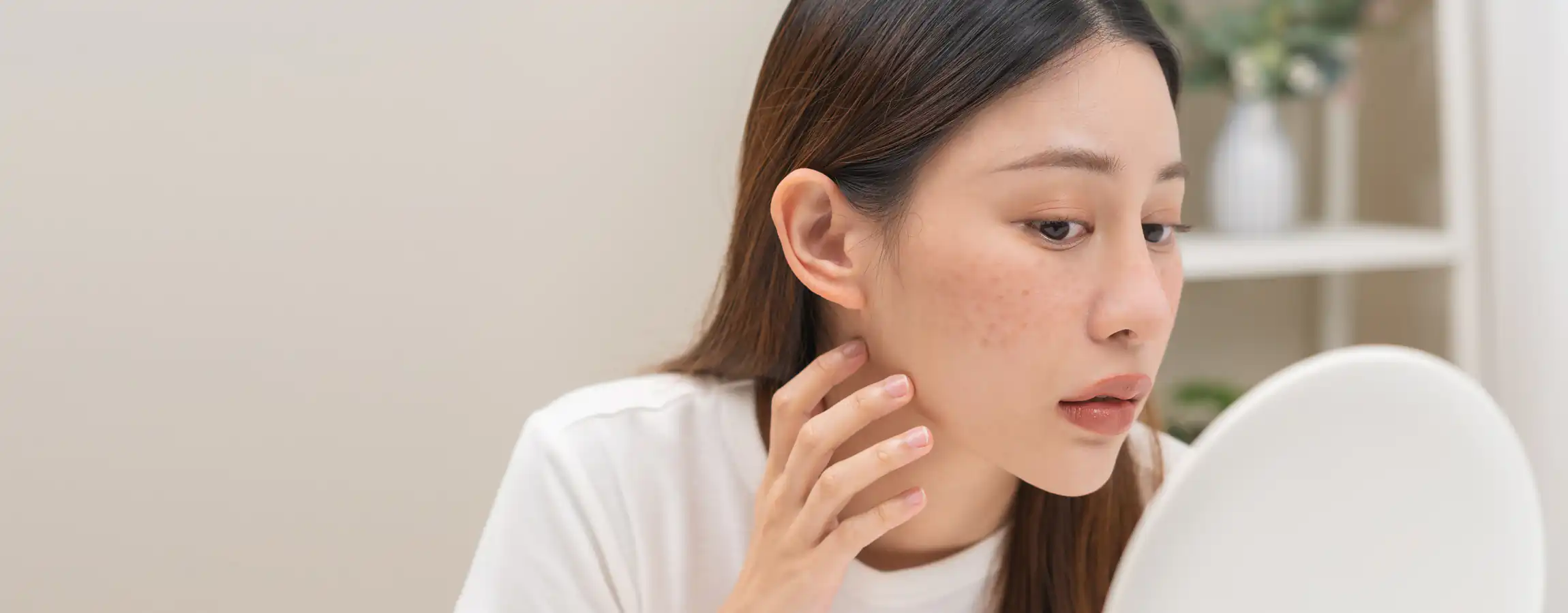 Woman displaying successful results from Bellafill Filler in Memphis
