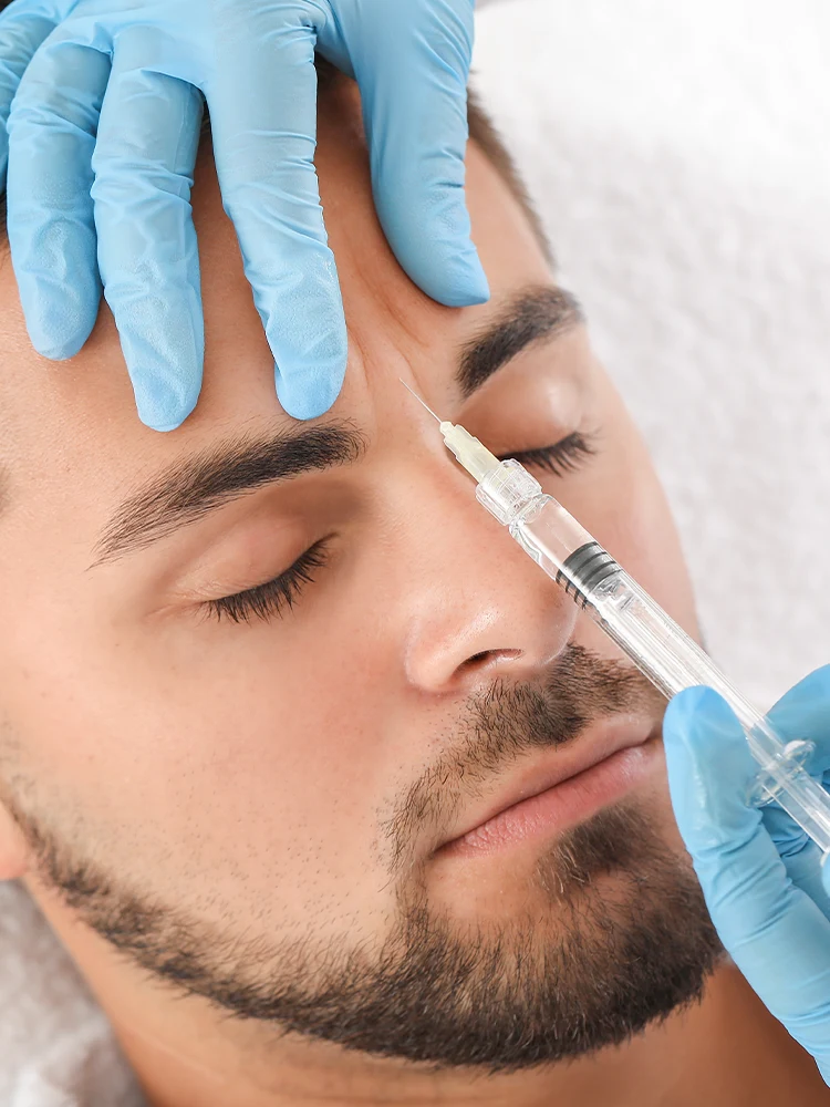 Patient receiving Bellafill filler injection to improved facial volume