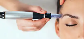 Collagen Induction Therapy for skin rejuvenation