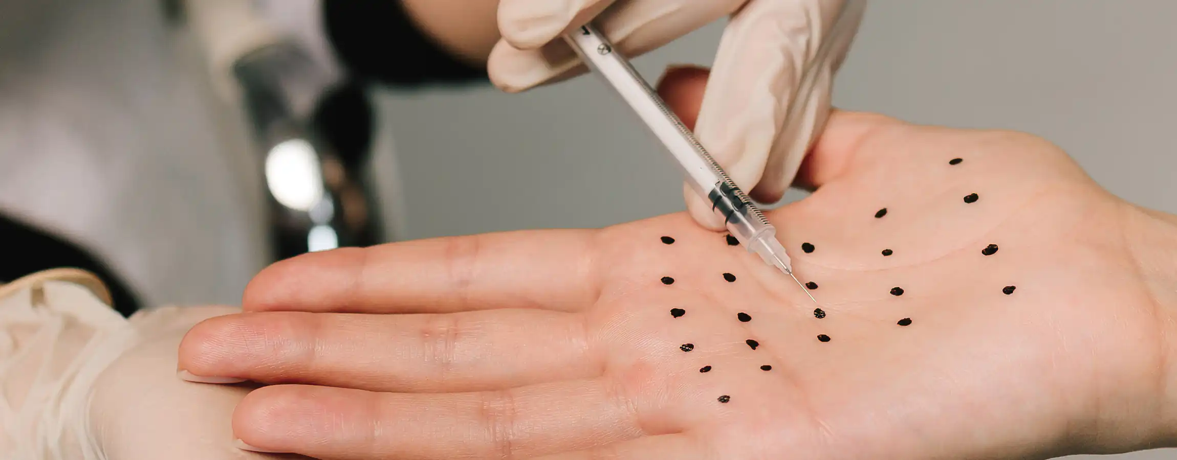 Woman displaying successful results from Radiesse Treatments in Memphis