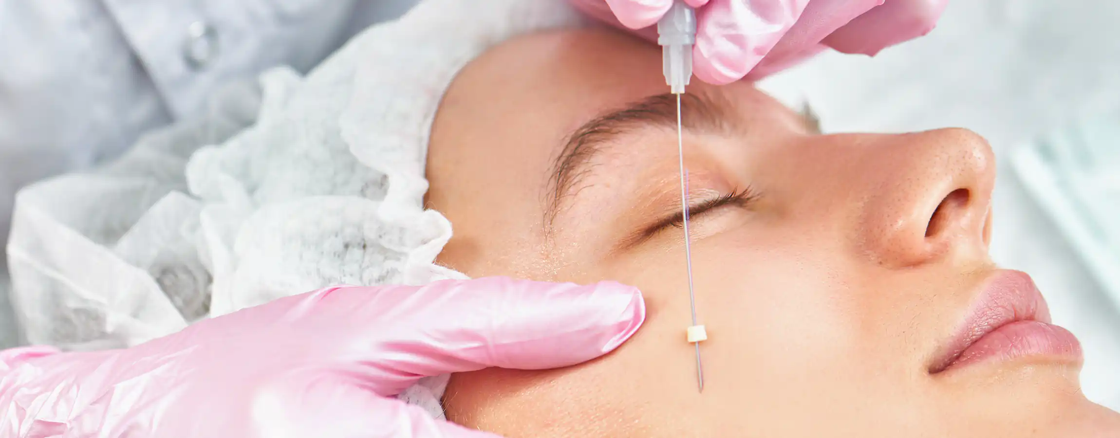 Sugar Threads Lift in Memphis | PDO Non-Surgical Facelift