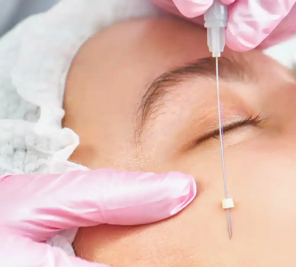 Sugar Thread Skin Rejuvenation treatment process