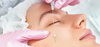 Sugar Thread Skin Rejuvenation for natural collagen stimulation