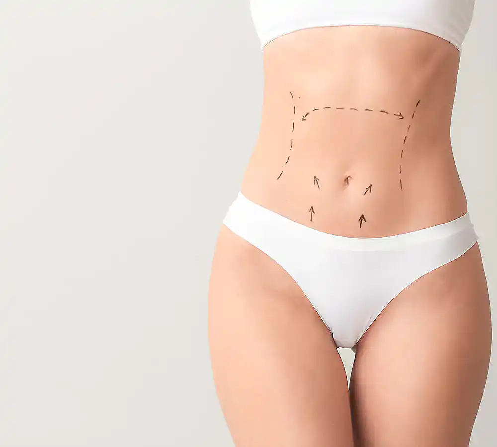 Eliminate Stubborn Fat with CoolSculpting in Memphis