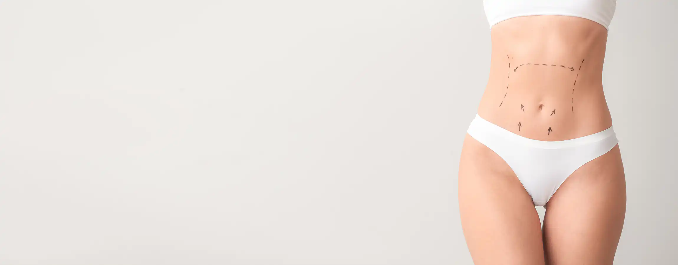 Woman displaying successful results from Tummy Tuck in Memphis