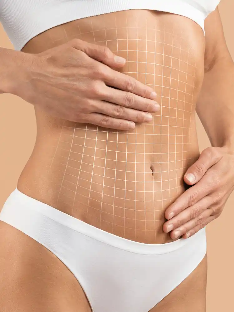 Before and after abdominal transformation results in Memphis, TN showing dramatic body contouring