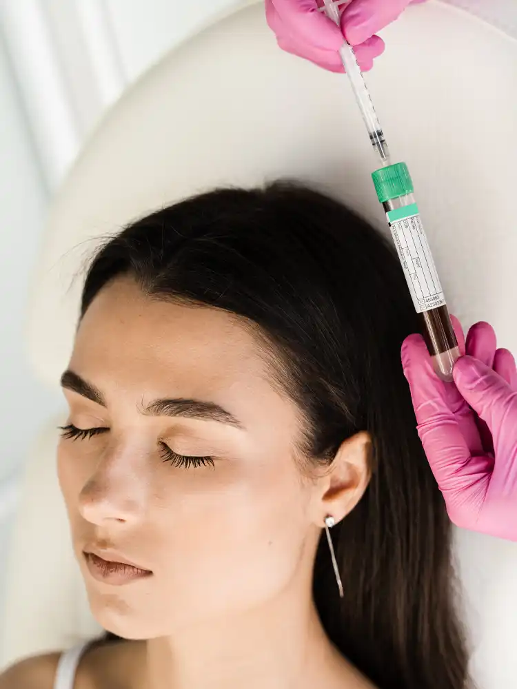 Patient showcasing vampire facial benefits and skin rejuvenation results