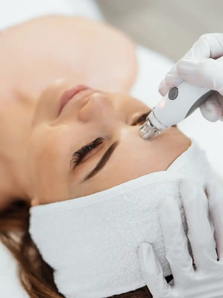 Stunning skin transformation demonstrating successful vampire facial results