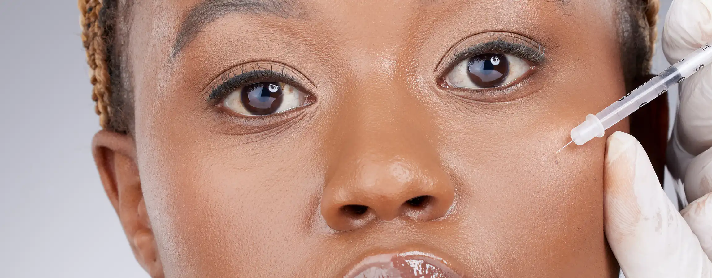 Woman displaying successful results from Juvéderm Treatments in Memphis